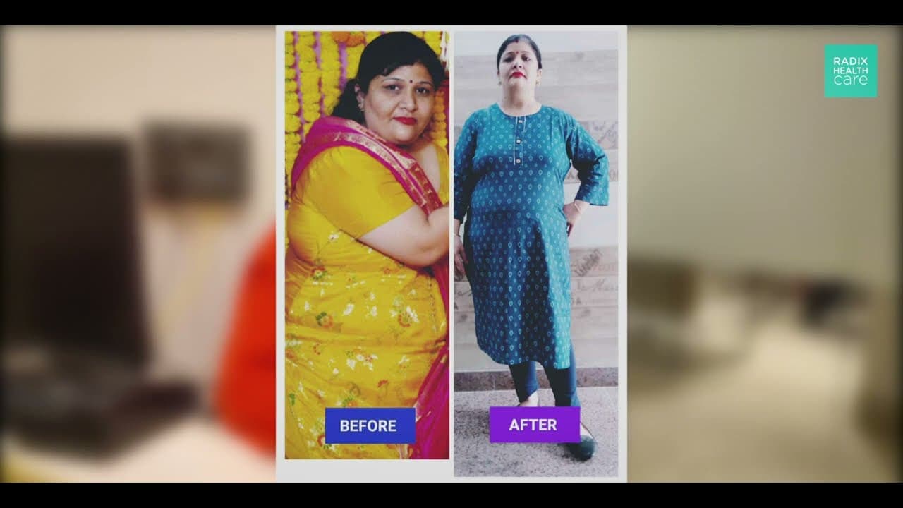 Our patients shares there weight loss journey experience with Dr Deepika Kohli at Radix Healthcare